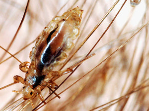 Getting Rid of Head Lice In Four Easy Steps.